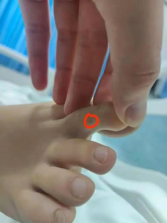 质疑医院延误救治！当地卫健委介入！开元棋牌女子三亚疑被蛇咬身亡家属(图6)